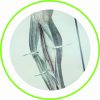 Traumatologie
